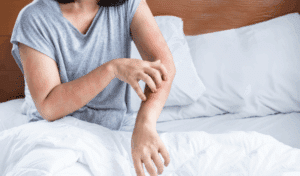 A person scratching at their skin which is red from an allergic reaction